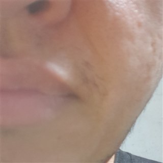 Mileum